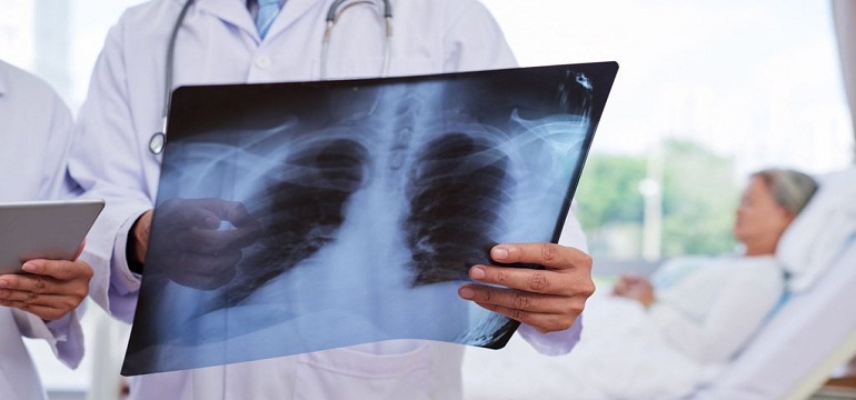 Penjelasan Ahli Biologi Bongkar Fakta Mengejutkan Hasil Rontgen Pasien Covid-19 yang Sudah dan Belum Divaksin